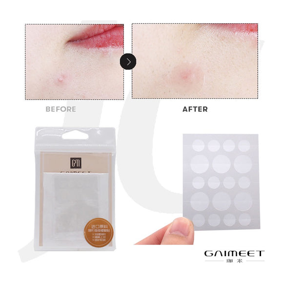 GAIMEET Pimple Repair Recover Cover Sticker 174H J61HSC